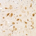 KO-Validated Smad1 Rabbit mAb (20 μl)