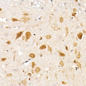KO-Validated Smad1 Rabbit mAb (20 μl)