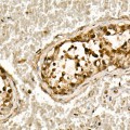 KO-Validated Smad3 Rabbit mAb (20 μl)