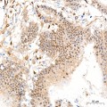 KO-Validated YAP1 Rabbit mAb (20 μl)