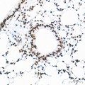 KO-Validated HDAC1 Rabbit mAb (20 μl)