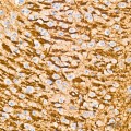 KD-Validated ATG7 Rabbit mAb (20 μl)