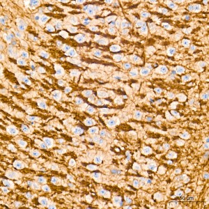 KD-Validated ATG7 Rabbit mAb (20 μl)