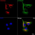 KD-Validated Vimentin Rabbit mAb (20 μl)