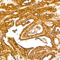 KO-Validated NF-kB p65/RelA Rabbit mAb (20 μl)
