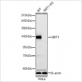 KO-Validated SIRT1 Rabbit mAb (20 μl)