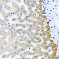 KO-Validated M6PR Rabbit pAb (20 μl)