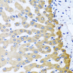 KO-Validated M6PR Rabbit pAb (20 μl)