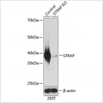 KO-Validated STRAP Rabbit pAb (20 μl)