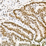 KO-Validated FTO Rabbit mAb (20 μl)