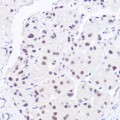 KO-Validated BRG1/SMARCA4 Rabbit pAb (20 μl)
