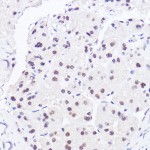 KO-Validated BRG1/SMARCA4 Rabbit pAb (20 μl)