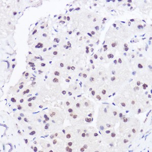 KO-Validated BRG1/SMARCA4 Rabbit pAb (20 μl)