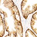 KD-Validated MRP4/ABCC4 Rabbit mAb (20 μl)