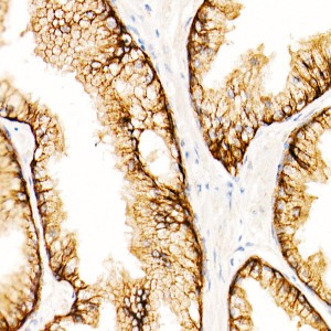 KD-Validated MRP4/ABCC4 Rabbit mAb (20 μl)