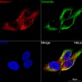KO-Validated Beclin 1 Rabbit mAb (20 μl)