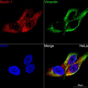 KO-Validated Beclin 1 Rabbit mAb (20 μl)