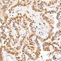 KO-Validated YAP1 Rabbit mAb (20 μl)