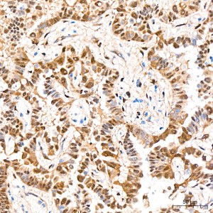 KO-Validated YAP1 Rabbit mAb (20 μl)