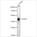 KO-Validated NDRG1 Rabbit pAb (20 μl)