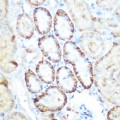 KO-Validated PEPCK/PCK2 Rabbit pAb (20 μl)