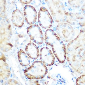 KO-Validated PEPCK/PCK2 Rabbit pAb (20 μl)