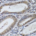 KO-Validated STAT5B Rabbit pAb (20 μl)