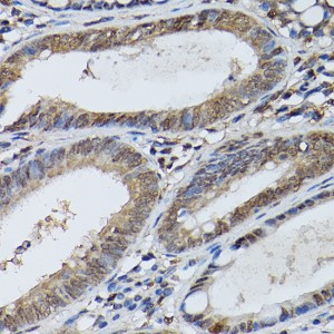 KO-Validated STAT5B Rabbit pAb (20 μl)