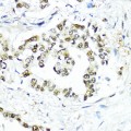 KO-Validated SUMO1 Rabbit pAb (20 μl)