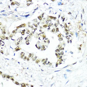 KO-Validated SUMO1 Rabbit pAb (20 μl)