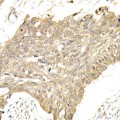 KO-Validated hnRNP E1/PCBP1 Rabbit pAb (20 μl)