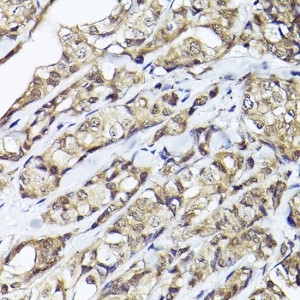 KO-Validated Smad1 Rabbit pAb (20 μl)