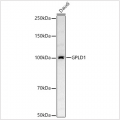 KD-Validated GPLD1 Rabbit pAb (20 μl)