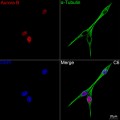 KD-Validated Aurora B Rabbit mAb (20 μl)