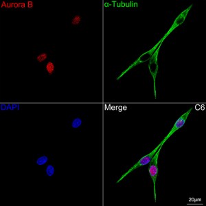 KD-Validated Aurora B Rabbit mAb (20 μl)