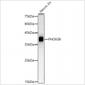 KD-Validated PHOX2B Rabbit pAb (20 μl)