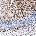 KO-Validated MSH2 Rabbit mAb (20 μl)