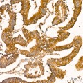 KO-Validated NF-kB p65/RelA Rabbit mAb (20 μl)