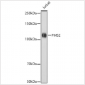 KO-Validated PMS2 Rabbit mAb (20 μl)