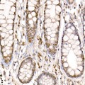 KO-Validated PRMT4/CARM1 Rabbit pAb (20 μl)