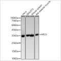 KO-Validated MCU Rabbit mAb (20 μl)