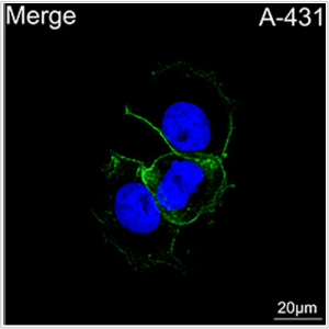 ABflo® 488 Rabbit anti-Human TROP-2 mAb (100 T)