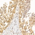 KO-Validated AKT1 Rabbit mAb (20 μl)