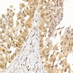 KO-Validated AKT1 Rabbit mAb (20 μl)