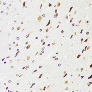 KO-Validated EDF1 Rabbit pAb (20 μl)