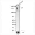 KD-Validated EGFR Rabbit mAb (20 μl)