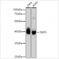 KO-Validated SMARCB1/SNF5 Rabbit mAb (20 μl)
