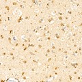 KO-Validated SMPD1 Rabbit mAb (20 μl)