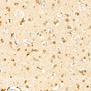 KO-Validated SMPD1 Rabbit mAb (20 μl)