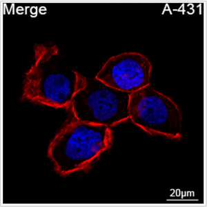 ABflo® 647 Rabbit anti-Human EGFR mAb (100 T)